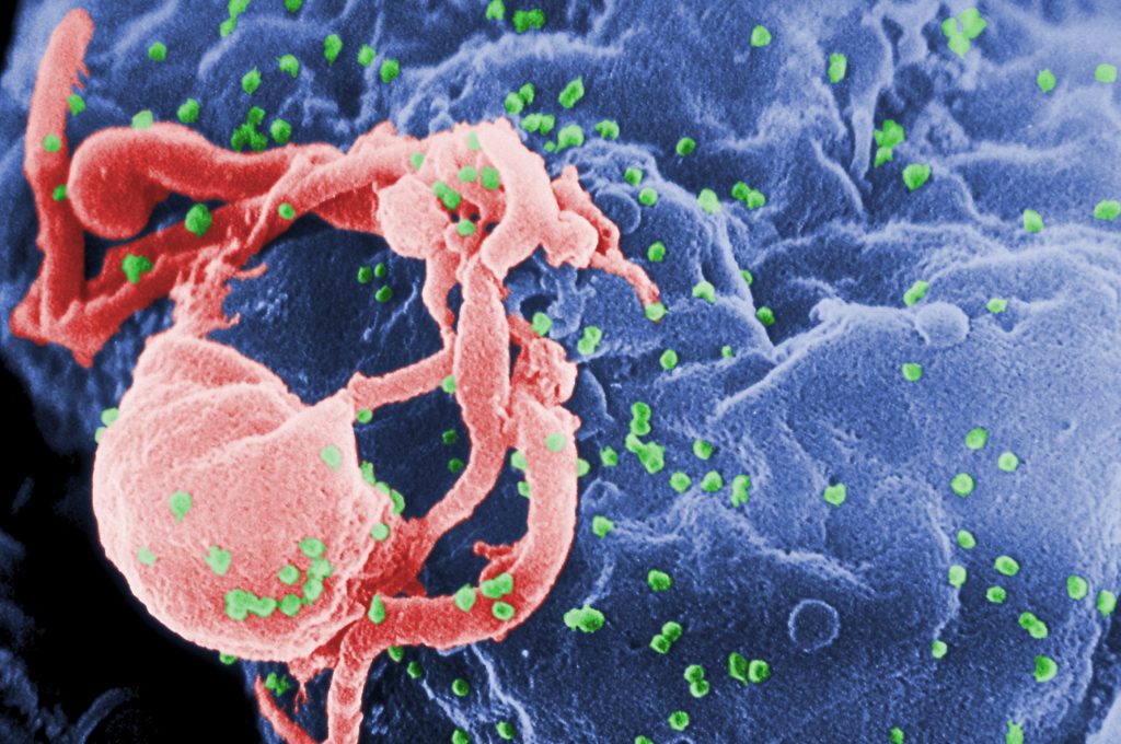Mit-Sicherheit-Besser-gegen-HIV-STI-AIDS-MSB-WEB-virus