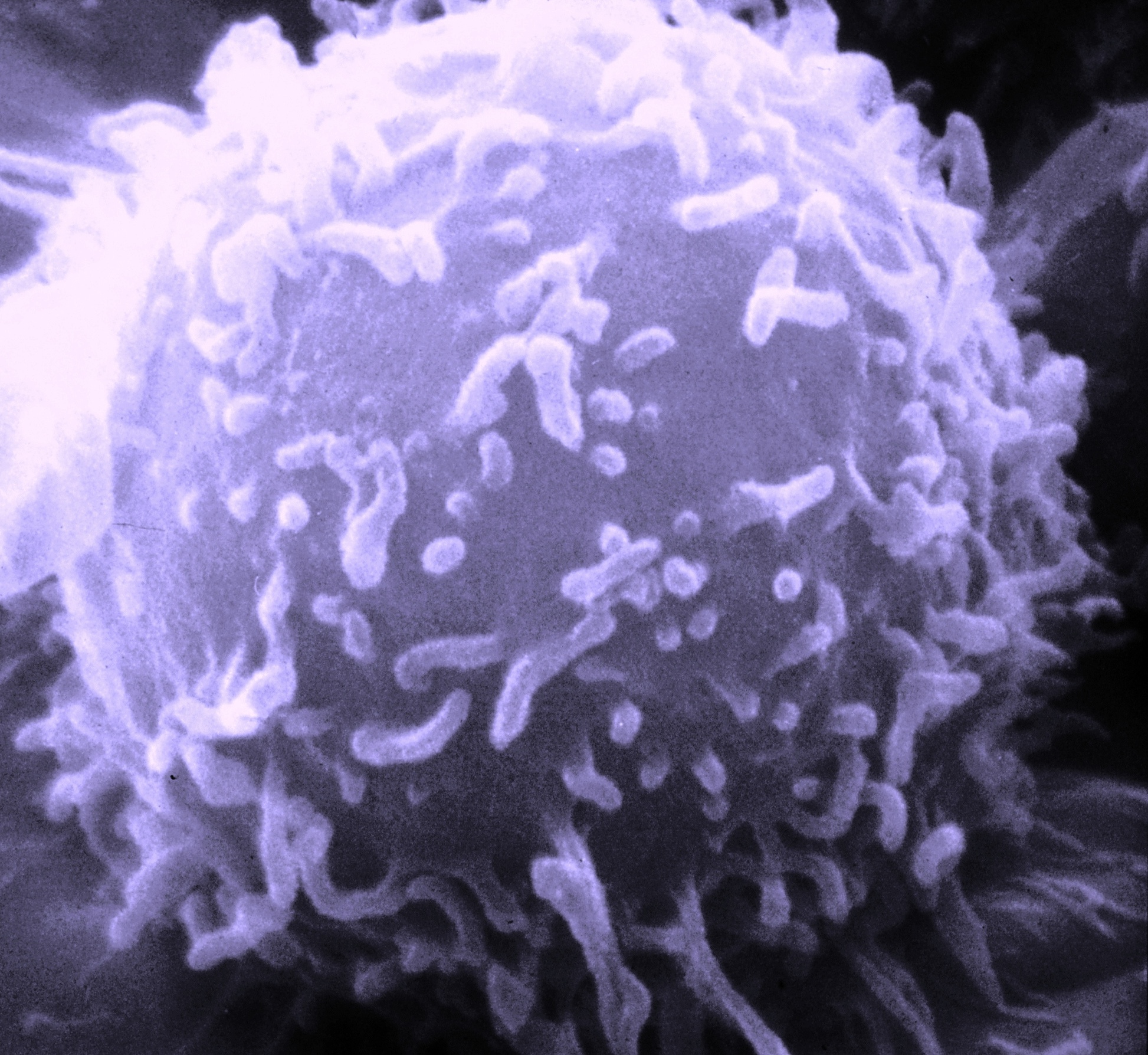 HI-Virus fotografiert durch ein Mikroskop