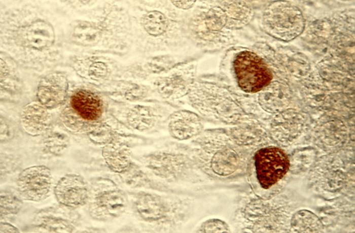 Abbildung von Chlamydia Trachomatis Einschlusskörperchen