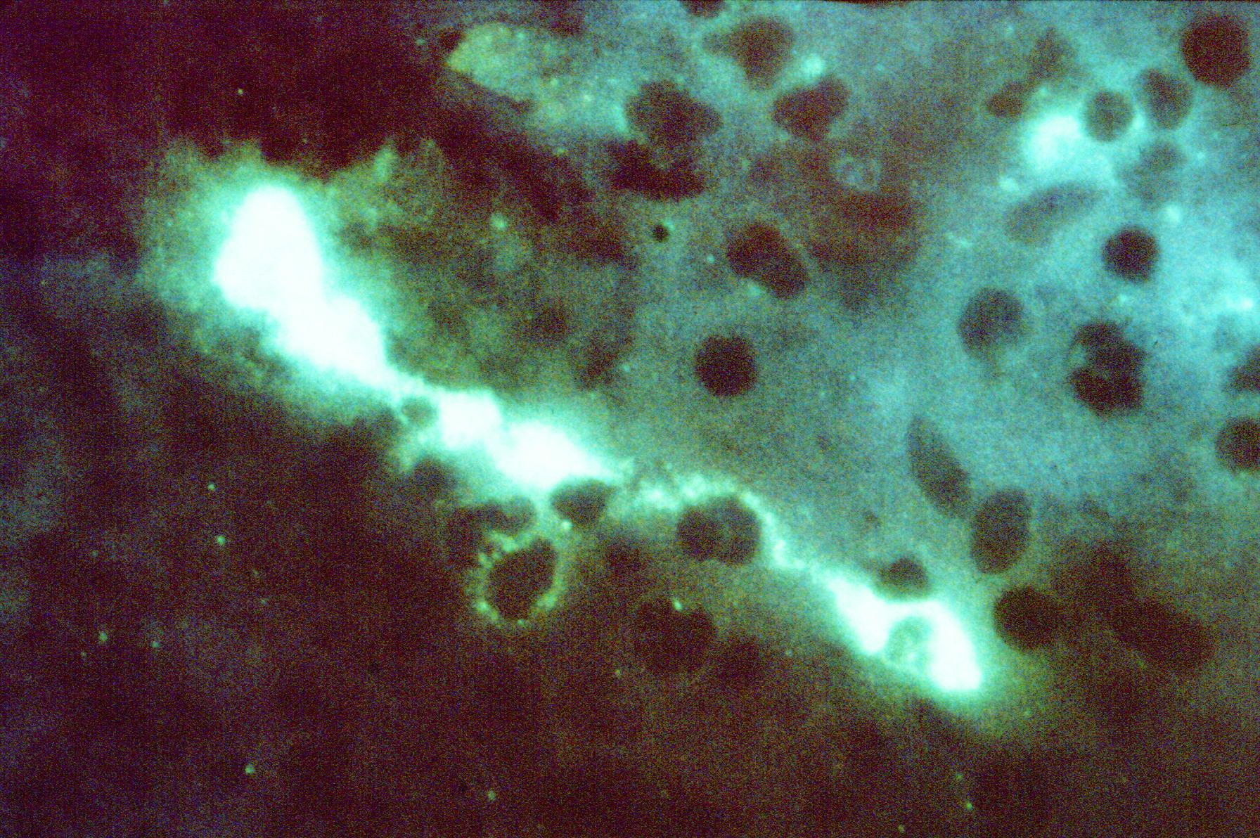 Ansicht von Chlamydien Bakterien unter dem Mikroskop