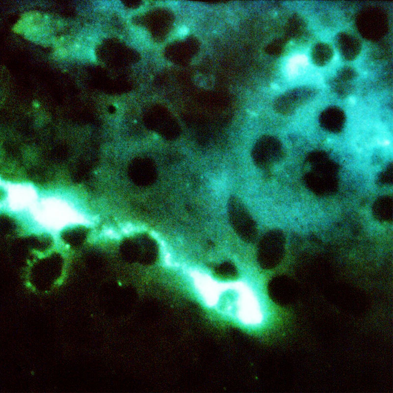 Ansicht von Chlamydien Bakterien unter dem Mikroskop