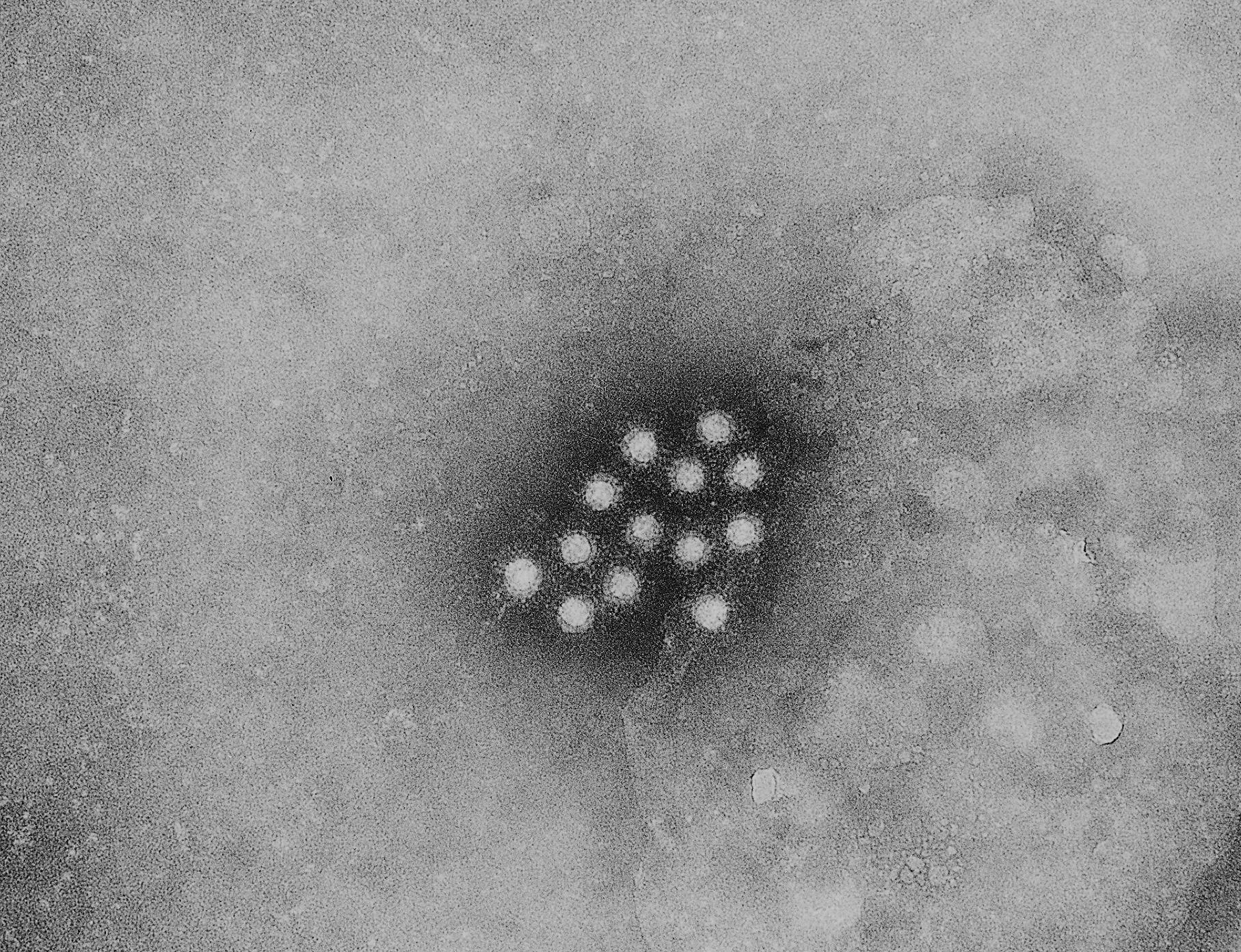 Schwarz-Weiß-Aufnahme des Hepatitis-A-Virus