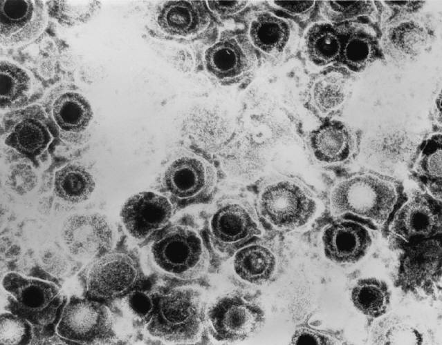 Aufnahme des Herpes-simplex-Virus