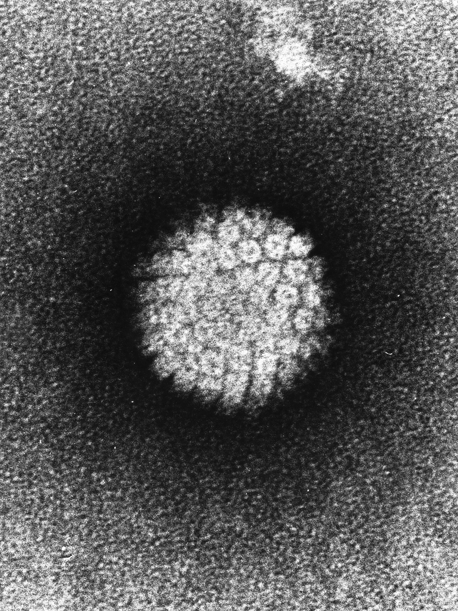 Schwarz weiße Abbildung einer Humane Papillomvire