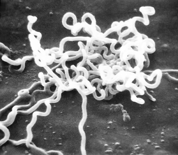 Elektronenmikroskopische Aufnahme des Bakterium Treponema pallidum