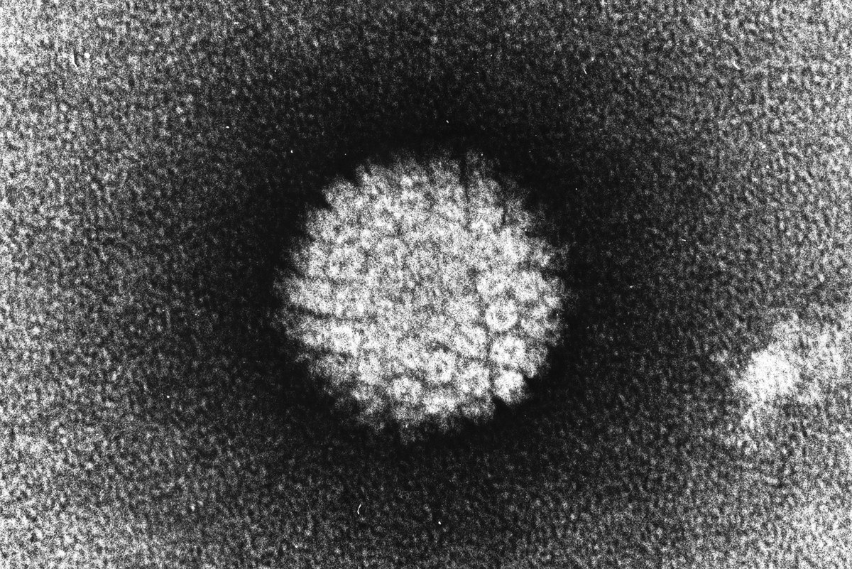 Ein Geschlechtskrankheiten STI Virus - Das Papilloma_Virus_HPV