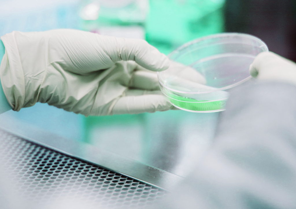Zwei Hände in Gummihanschuhen halten ein Probengefäass für einen STI-Test in der Hand