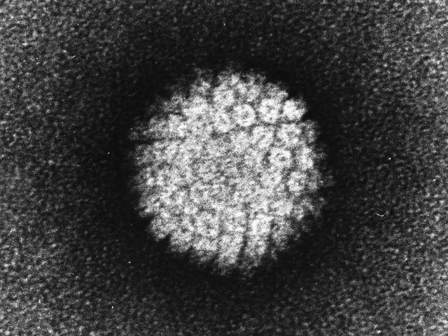 Schwarz weiße Abbildung einer Humane Papillomvire